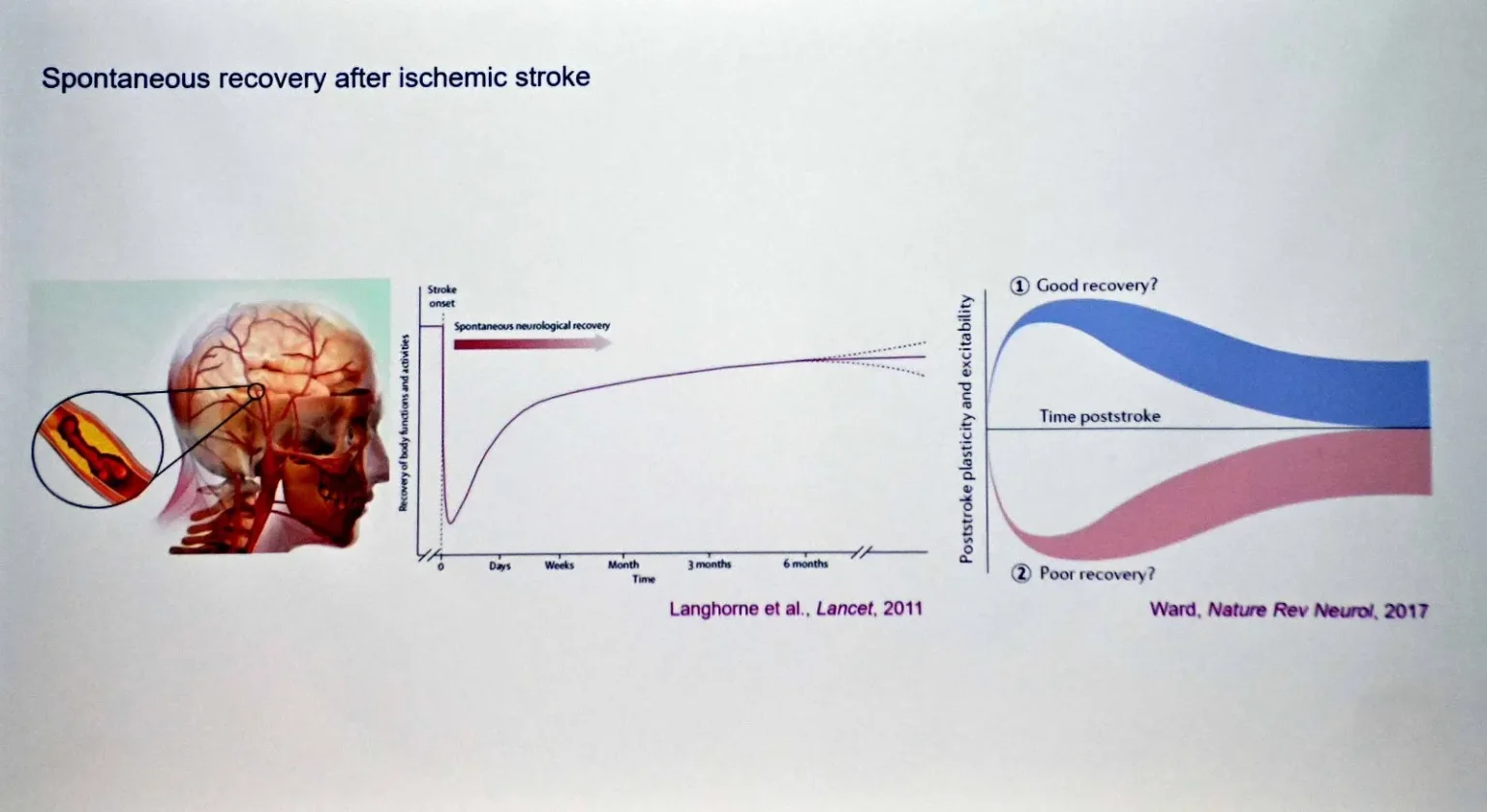 Luis Tovar examina formas de recuperación del cerebro