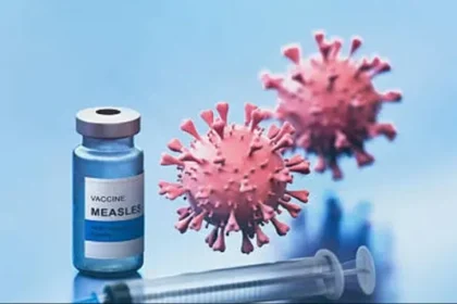 ¿Cuántos días tardan en aparecer los síntomas del sarampión