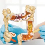 Estudio de la UNAM vincula sucralosa con riesgo de cáncer