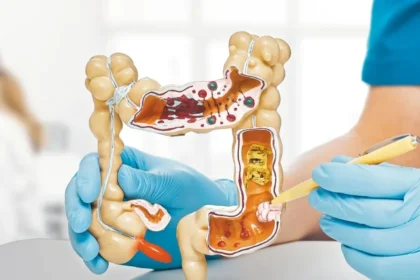 Estudio de la UNAM vincula sucralosa con riesgo de cáncer