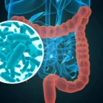 Brote de ciclosporiasis Cómo protegerte de esta infección parasitaria