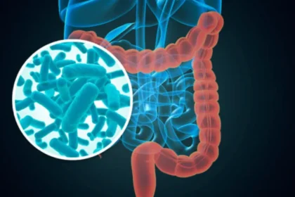 Brote de ciclosporiasis Cómo protegerte de esta infección parasitaria