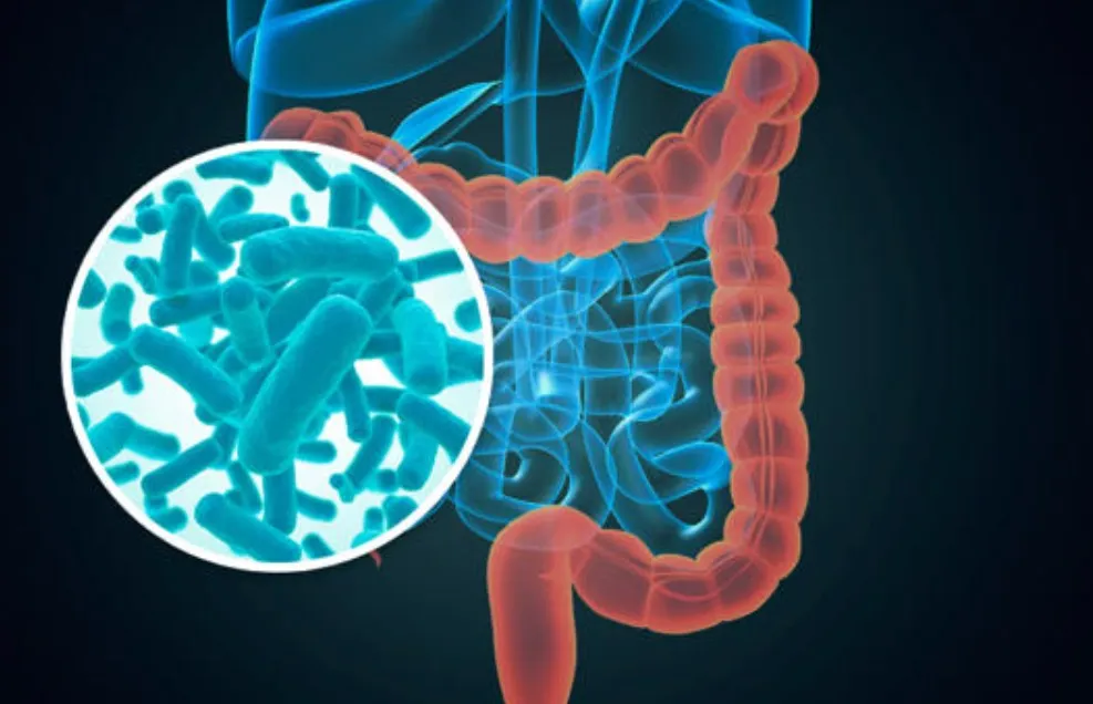 Brote de ciclosporiasis Cómo protegerte de esta infección parasitaria